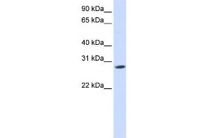 WB Suggested Anti-KCNIP4 Antibody Titration:  0. (KCNIP4 抗体  (N-Term))