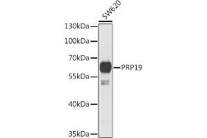 Western blot analysis of extracts of SW620 cells, using PRP19 antibody (ABIN6132439, ABIN6146257, ABIN6146259 and ABIN6222419) at 1:1000 dilution. (PRP19 抗体  (AA 1-220))