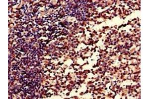 Immunohistochemistry of paraffin-embedded human tonsil tissue using ABIN7148409 at dilution of 1:100 (CD35 抗体  (AA 901-1095))