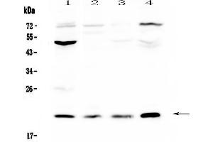 Western blot analysis of Kallikrein 2  using anti-Kallikrein 2  antibody . (Kallikrein 2 抗体  (AA 25-261))