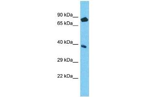 Host: Rabbit Target Name: NPEPL1 Sample Type: ACHN Whole Cell lysates Antibody Dilution: 1. (NPEPL1 抗体  (N-Term))