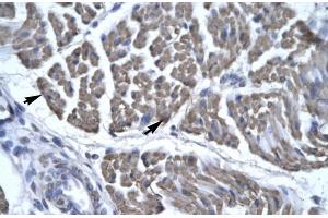 Human Skeletal Muscle (EYA3 抗体  (Middle Region))