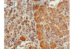 Immunohistochemistry of paraffin-embedded human adrenal gland tissue using ABIN7147287 at dilution of 1:100 (CDC6 抗体  (AA 1-141))
