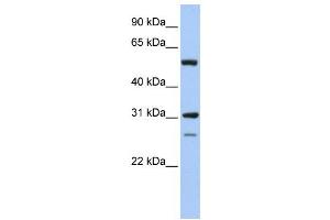 Western Blotting (WB) image for anti-Inosine 5'-Phosphate Dehydrogenase 1 (IMPDH1) antibody (ABIN2459738) (IMPDH1 抗体)