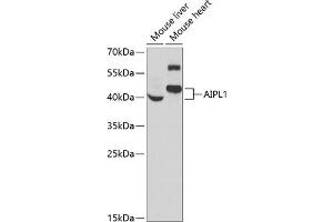 Western blot analysis of extracts of various cell lines, using  antibody (ABIN6129964, ABIN6136691, ABIN6136693 and ABIN6222112) at 1:1000 dilution.