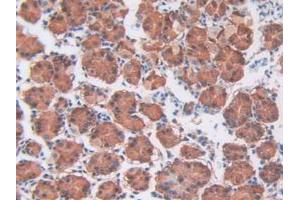 IHC-P analysis of Human Stomach tissue, with DAB staining. (CDCP1 抗体  (AA 689-836))