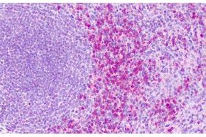 Anti-S1PR4 / EDG6 antibody IHC staining of human spleen. (S1PR4 抗体  (Cytoplasmic Domain))