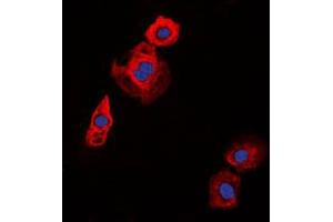 Immunofluorescence (IF) image for anti-Collagen, Type XX, alpha 1 (COL20A1) (C-Term) antibody (ABIN7298290)
