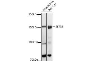 Western blot analysis of extracts of various cell lines, using SETD5 antibody (ABIN6132960, ABIN6147644, ABIN6147646 and ABIN6223140) at 1:1000 dilution. (SETD5 抗体  (AA 520-740))