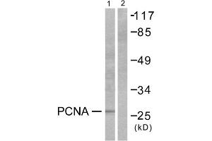 Western blot analysis of extracts from HepG2 cells, using PCNA antibody (ABIN5976487). (PCNA 抗体  (Internal Region))