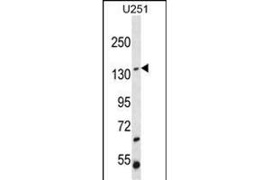 ST5 Antibody (C-term ) (ABIN652186 and ABIN2840676) western blot analysis in  cell line lysates (35 μg/lane). (ST5 抗体  (C-Term))
