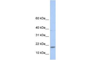 WB Suggested Anti-MAX Antibody Titration:  0.