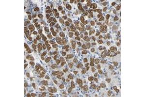 Immunohistochemical staining of human stomach with OTOF polyclonal antibody  shows strong cytoplasmic positivity in glandular cells at 1:50-1:200 dilution. (Otoferlin 抗体)