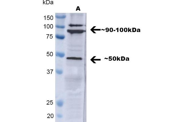 TNFRSF1A 抗体  (AA 20-43) (Atto 488)