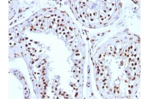 Immunohistochemistry (IHC) image for anti-Histone H1 antibody (ABIN6939596)
