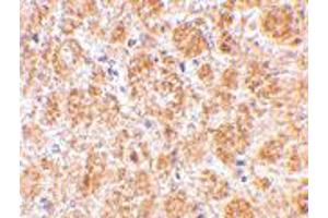 Immunohistochemistry of DARC in mouse brain tissue with DARC polyclonal antibody  at 2. (DARC 抗体  (C-Term))