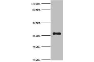 Western blot All lanes: AKR1B10 antibody at 4 μg/mL + A549 whole cell lysate Secondary Goat polyclonal to rabbit IgG at 1/10000 dilution Predicted band size: 36 kDa Observed band size: 36 kDa (AKR1B1 抗体  (AA 1-316))