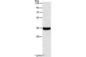 Western blot analysis of Human fetal liver tissue, using FGL1 Polyclonal Antibody at dilution of 1:500 (FGL1 抗体)