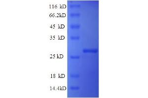 SDS-PAGE (SDS) image for Indian Hedgehog (IHH) (AA 203-411) protein (His tag) (ABIN5711311)