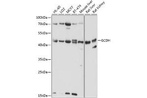 Western blot analysis of extracts of various cell lines, using GCDH antibody (ABIN6132101, ABIN6141009, ABIN6141010 and ABIN6224875) at 1:1000 dilution. (GCDH 抗体  (AA 149-438))