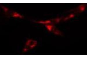 ABIN6277886 staining  NIH-3T3 cells by IF/ICC. (PKD2 抗体  (N-Term))