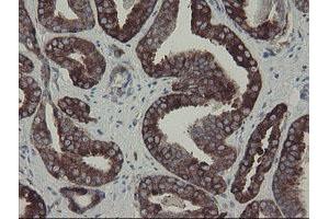 Image no. 6 for anti-C-Type Lectin Domain Family 4, Member E (CLEC4E) antibody (ABIN1497530)