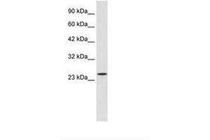 Image no. 1 for anti-Zinc Finger Protein 22 (ZNF22) (C-Term) antibody (ABIN202085) (Zinc Finger Protein 22 抗体  (C-Term))