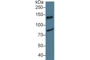 Western Blot; Sample: Human Jurkat cell lysate; Primary Ab: 3µg/ml Rabbit Anti-Rat LIG1 Antibody Second Ab: 0. (LIG1 抗体  (AA 568-875))