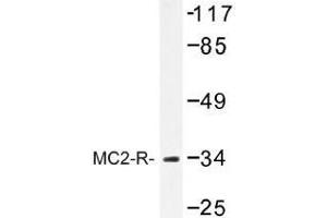 Image no. 1 for anti-Melanocortin 2 Receptor (Adrenocorticotropic Hormone) (MC2R) antibody (ABIN317741) (MC2R 抗体)