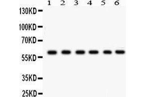 Western Blotting (WB) image for anti-Cytochrome P450, Family 24, Subfamily A, Polypeptide 1 (CYP24A1) (AA 153-514) antibody (ABIN3042784)