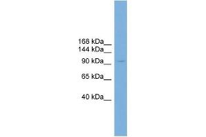 Human HT1080; WB Suggested Anti-PIWIL4 Antibody Titration: 0. (PIWIL4 抗体  (N-Term))
