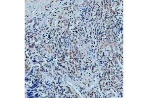 Immunohistochemical analysis of 42278 staining in human tonsil formalin fixed paraffin embedded tissue section. (POU2F1 抗体)