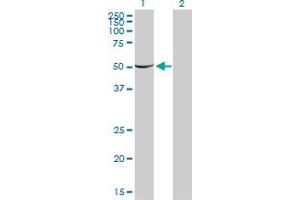 Western Blot analysis of PGM1 expression in transfected 293T cell line by PGM1 monoclonal antibody (M01), clone 3B8-H4.