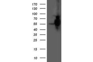 Western Blotting (WB) image for anti-Histidyl-tRNA Synthetase 2, Mitochondrial (Putative) (HARS2) antibody (ABIN1498582) (HARS2 抗体)