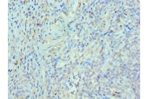 Immunohistochemistry of paraffin-embedded human epityphlon tissue using ABIN7172544 at dilution of 1:100 (ETV6 抗体  (AA 1-300))