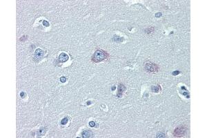 Immunohistochemistry (IHC) image for anti-Transient Receptor Potential Cation Channel, Subfamily M, Member 2 (TRPM2) (N-Term) antibody (ABIN2781840)