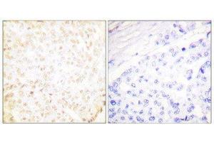 Immunohistochemistry (IHC) image for anti-X-Ray Repair Complementing Defective Repair in Chinese Hamster Cells 5 (Double-Strand-Break Rejoining) (XRCC5) (C-Term) antibody (ABIN1848902)