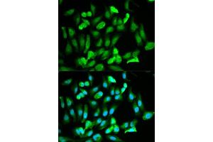 Immunofluorescence (IF) image for anti-ERG, ETS transcription factor (ERG) (AA 1-280) antibody (ABIN3021820)