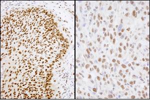 Immunohistochemistry (IHC) image for anti-Matrin 3 (MATR3) (AA 475-500) antibody (ABIN7453407)