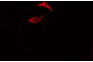 ABIN6275474 staining Hela cells by IF/ICC. (RAP2B 抗体  (Internal Region))