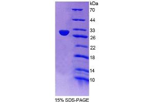 SDS-PAGE analysis of Human NAIP Protein. (NAIP 蛋白)