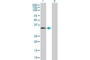 Western Blot analysis of CPNE5 expression in transfected 293T cell line by CPNE5 MaxPab polyclonal antibody. (Copine V 抗体  (AA 1-301))