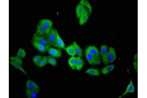 Immunofluorescent analysis of HepG2 cells using ABIN7160716 at dilution of 1:100 and Alexa Fluor 488-congugated AffiniPure Goat Anti-Rabbit IgG(H+L) (Aminoacylase 3 抗体  (AA 5-319))