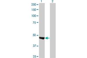 Western Blot analysis of KIAA0261 expression in transfected 293T cell line by KIAA0261 monoclonal antibody (M02), clone 2B3. (WAPAL 抗体  (AA 1-402))