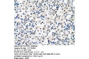 Rabbit Anti-HSP90B1 Antibody  Paraffin Embedded Tissue: Human Liver Cellular Data: Hepatocytes Antibody Concentration: 4. (GRP94 抗体  (N-Term))