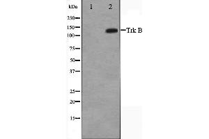 Western blot analysis of Trk B expression in HepG2 whole cell lysates,The lane on the left is treated with the antigen-specific peptide. (TRKB 抗体  (C-Term))