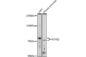 Western blot analysis of extracts of various cell lines, using KCNQ1 Rabbit pAb (ABIN3023120, ABIN3023121, ABIN3023122 and ABIN6219399) at 1:1000 dilution. (KCNQ1 抗体  (AA 250-549))