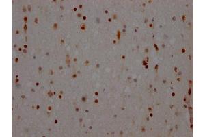 IHC image of ABIN7127643 diluted at 1:100 and staining in paraffin-embedded human brain tissue performed on a Leica BondTM system. (Recombinant NONO 抗体)