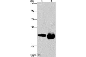 Western blot analysis of A549 and Raji cell, using CD38 Polyclonal Antibody at dilution of 1:520 (CD38 抗体)
