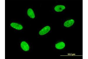 Immunofluorescence of monoclonal antibody to LBX2 on HeLa cell. (LBX2 抗体  (AA 95-194))